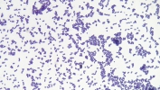 استافیلوکوک - Staphylococcus